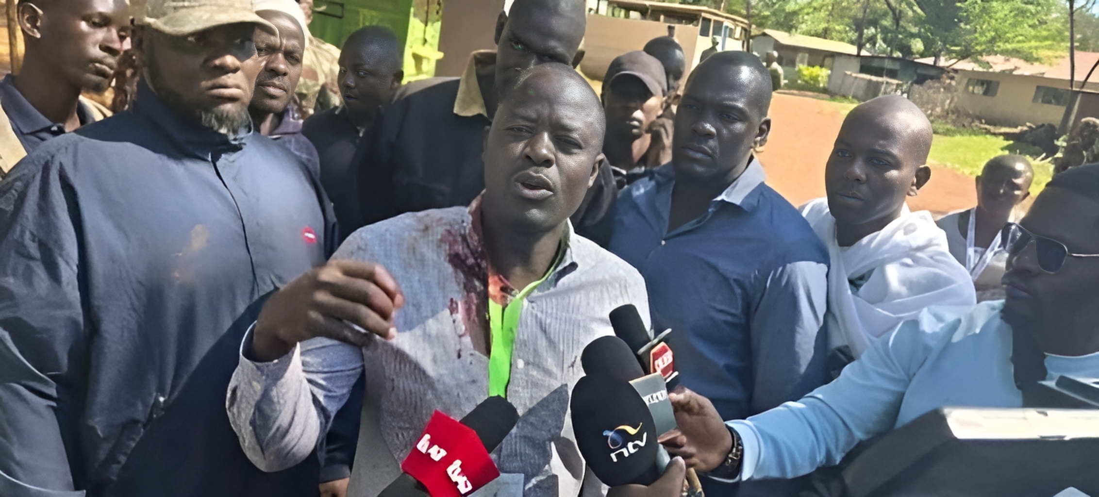 Kaluma Apigwa Jiwe Kichwani, Mlinzi Apokonywa Bunduki